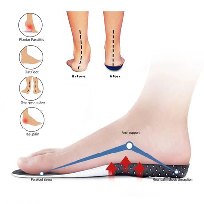 FootPeers™ Orthopedic Insoles - Instant Pain Relieving and Shock Absorbing
